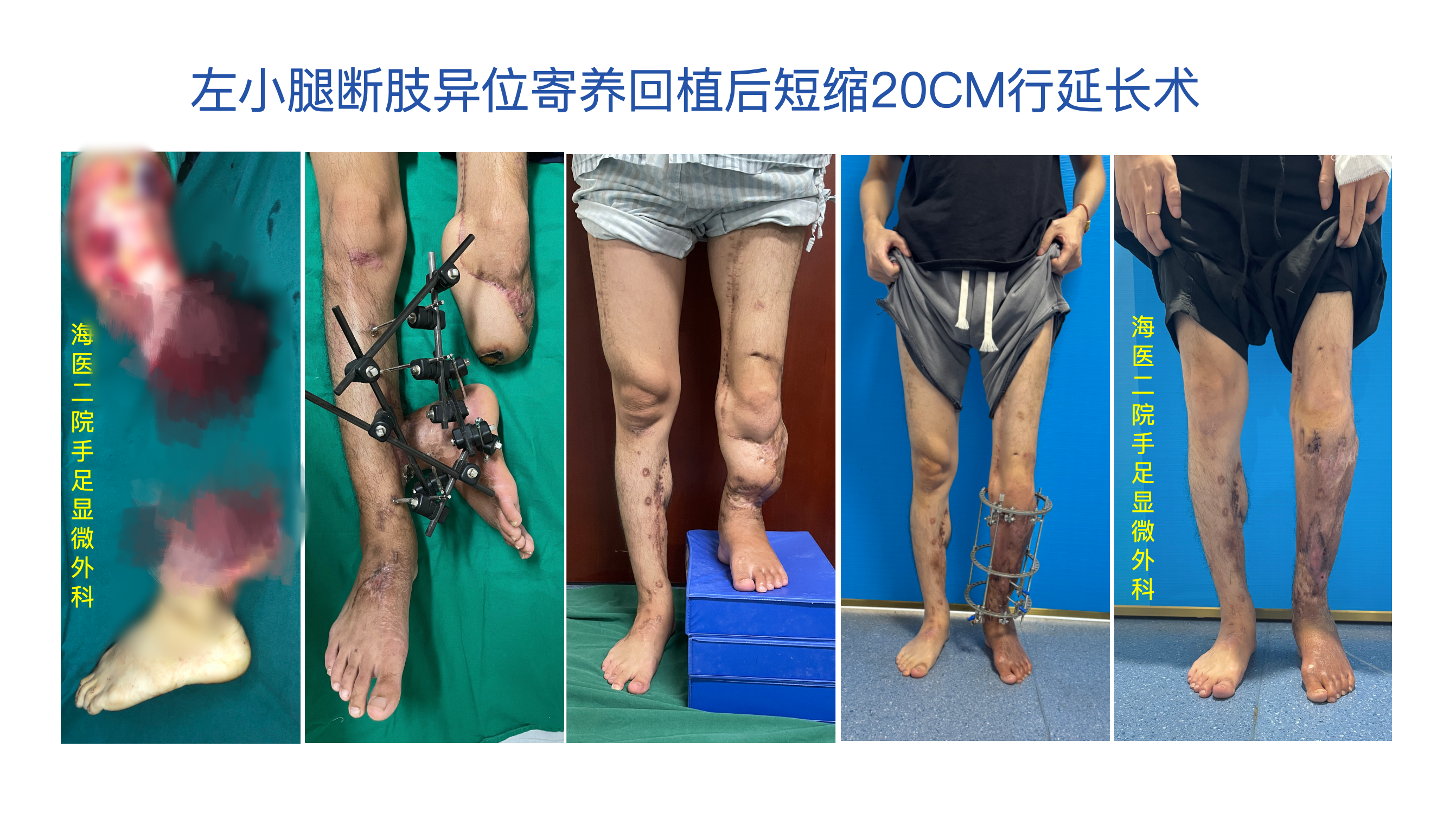 手足显微外科配图.png
